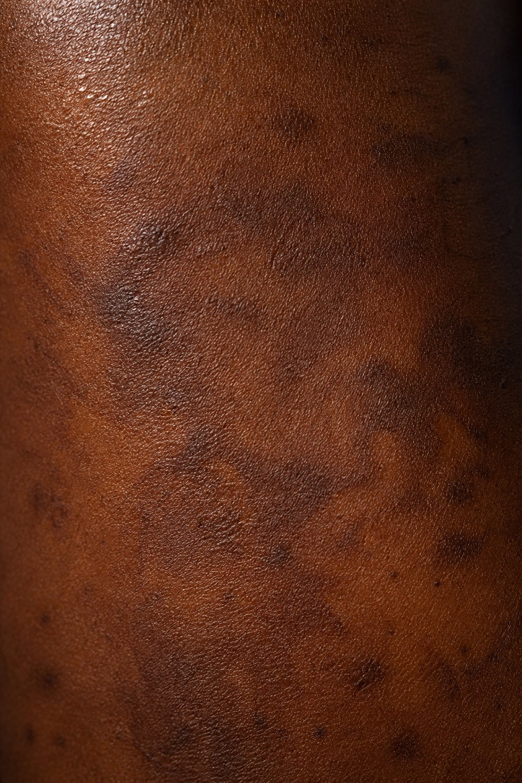 Close-up skin texture associated with hyperpigmentation