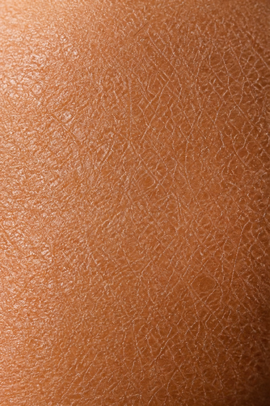 Close-up dry texture associated with ichthyosis vulgaris