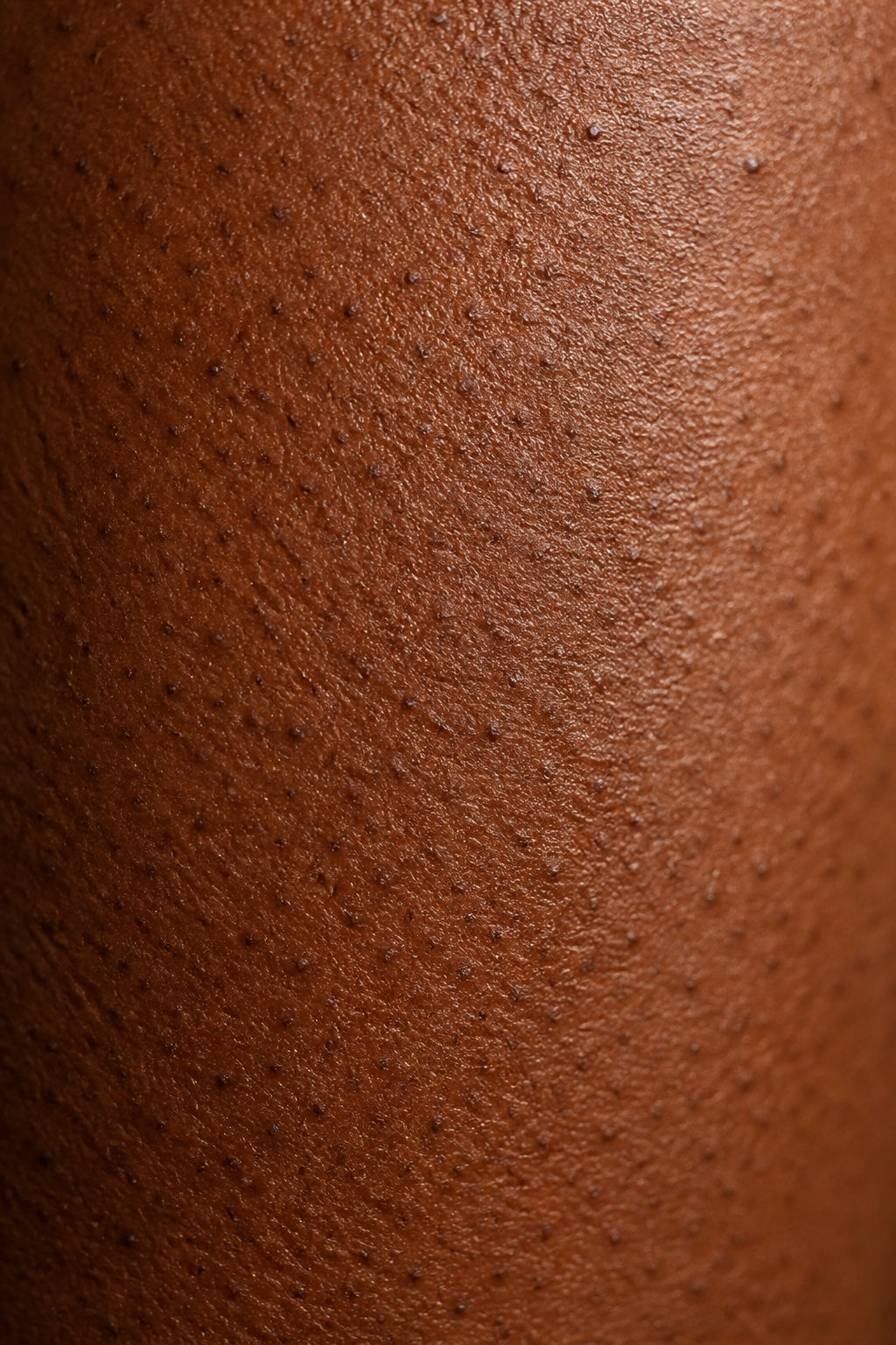Close-up texture associated with keratosis pilaris