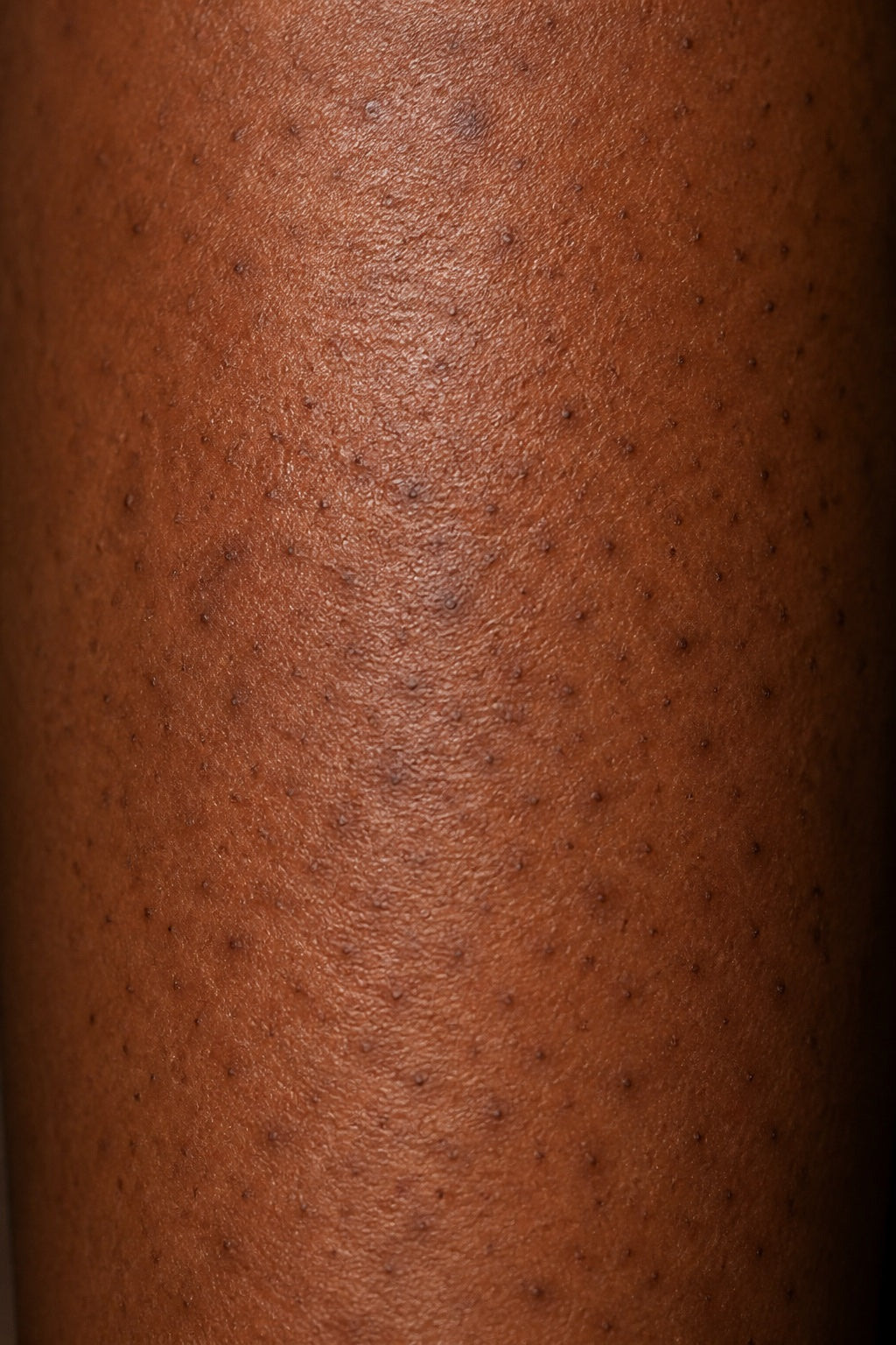 Close-up texture associated with strawberry legs